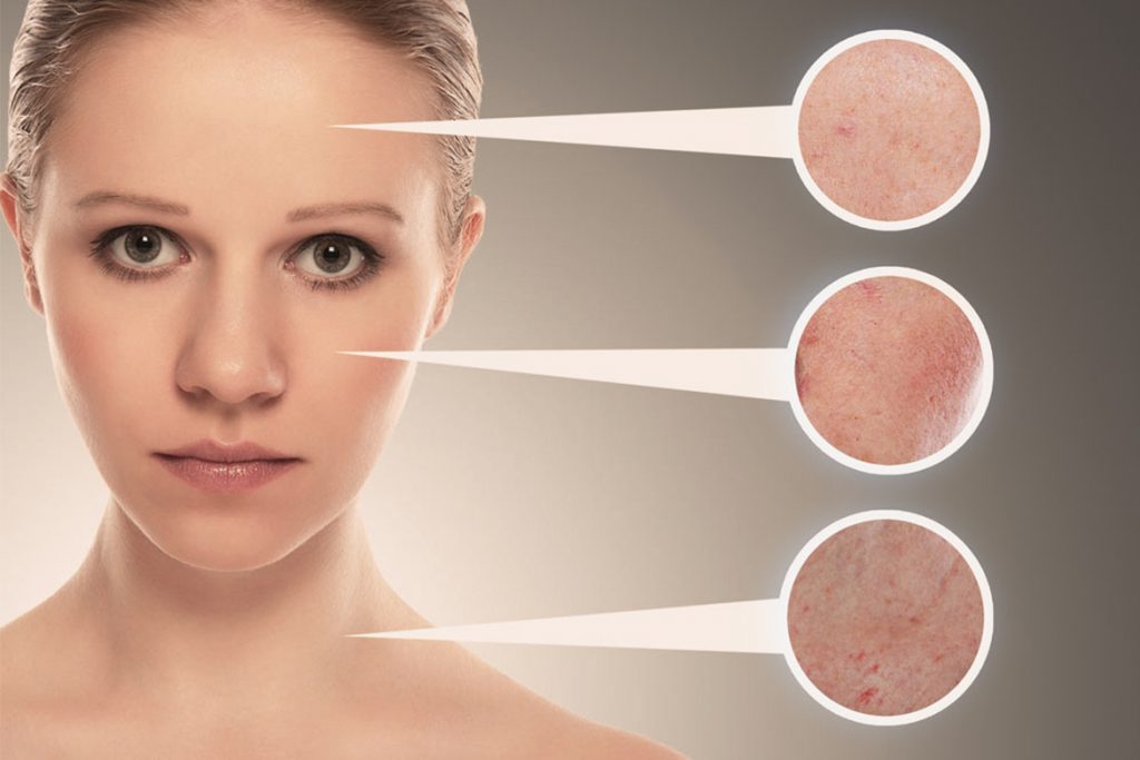 skin problem