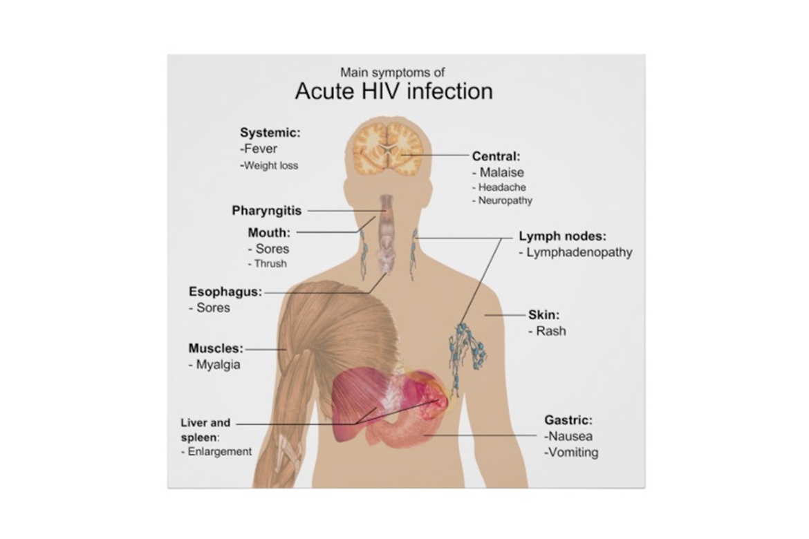 advanced hiv disease symptoms