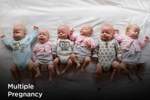 multiple pragnancy