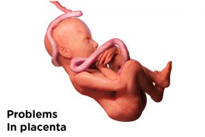 problem in placenta