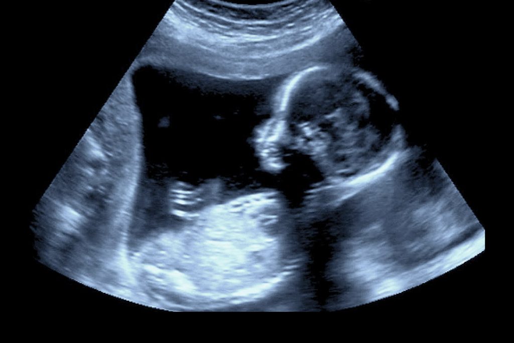 13 week baby's ultrasound